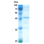 Epstein-Barr Virus (EBV) VCA p18 protein (capture)