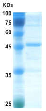 Epstein-Barr Virus (EBV) VCA p18 protein (capture)