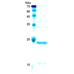 Epstein-Barr Virus (EBV) VCA p18 protein (detection)