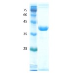 Deamidated gliadin peptide antigen 