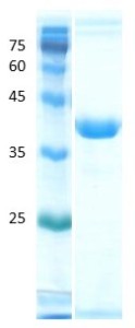 Deamidated gliadin peptide antigen Deamidated gliadin peptide antigen