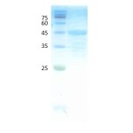 Deamidated gliadin peptide antigen 