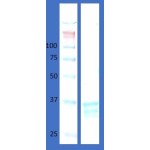 Human hemoglobin variant D