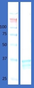 Human hemoglobin variant D