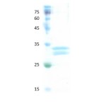 Human hemoglobin variant E