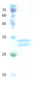 Human hemoglobin variant E