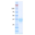 Human hemoglobin variant S