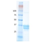 Human hemoglobin variant C