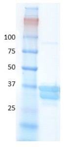 Human hemoglobin variant C