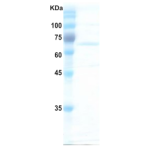 Hepatitis C virus (HCV) NS3 protein  (AA1192-1492)