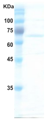 Hepatitis C virus (HCV) NS3 protein  (AA1192-1492)