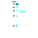 Hepatitis C virus (HCV) NS3 protein  (AA1368-1490)