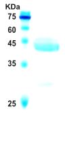 Hepatitis C virus (HCV) NS3 protein  (AA1368-1490)