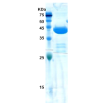 Hepatitis C virus (HCV) NS3 protein  (AA1192-1367)