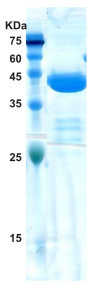 Hepatitis C virus (HCV) NS3 protein  (AA1192-1367)