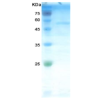 HIV-2 gag p26 protein