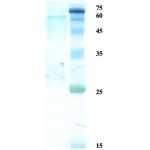 Herpes simplex virus Type 1 (HSV-1) glycoprotein G