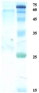 Herpes simplex virus Type 1 (HSV-1) glycoprotein G