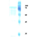 Herpes simplex virus Type 2 (HSV-2) glycoprotein G