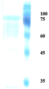Herpes simplex virus Type 2 (HSV-2) glycoprotein G