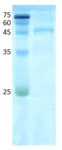 Alternaria tenuis (alt a 1)
