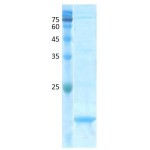 Aspergillus fumigatus (asp f 1)