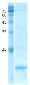 Aspergillus fumigatus (asp f 1) Aspergillus fumigatus (asp f 1)