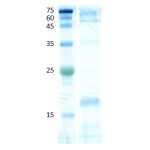 Dermatophagoides farinae (der f 2)