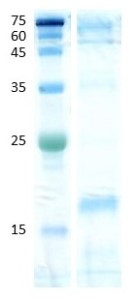 Dermatophagoides farinae (der f 2) Dermatophagoides farinae (der f 2)