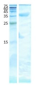 Penicillium notatum (pen n 18)