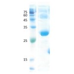 Dermatophagoides pteronyssinus (der p 1)