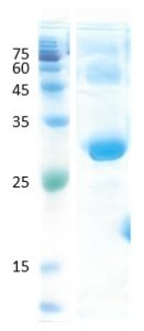 Dermatophagoides pteronyssinus (der p 1)