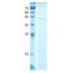 Short ragweed common (amb a 1.1)