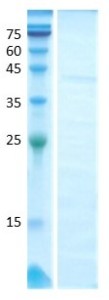 Short ragweed common (amb a 1.1)