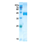 Trypanosoma cruzi chimeric chagas protein (capture)