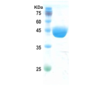 Chikungunya capsid protein