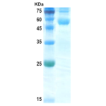 Chikungunya wild type envelope E1 protein (insect cell)