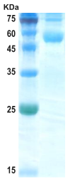 Chikungunya wild type envelope E1 protein (insect cell)