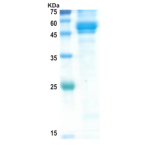 Chikungunya mutant envelope E1 protein (insect cell)