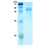 Cytomegalovirus (CMV) pp 52 (UL44) protein