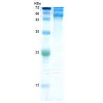 Dengue type 1 envelope protein (insect cell)