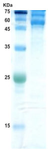 Dengue type 1 envelope protein (insect cell)