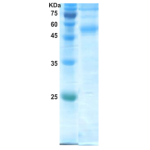 Dengue type 2 envelope protein (insect cell)