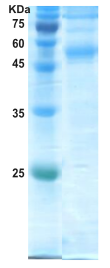 Dengue type 2 envelope protein (insect cell)