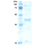 Dengue type 3 envelope protein (insect cell)