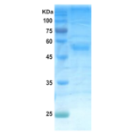 Dengue type 4 envelope protein (insect cell)