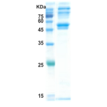 Dengue type 1 NS1 protein (insect cell)