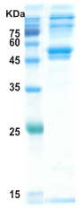 Dengue type 1 NS1 protein (insect cell)