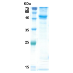 Dengue type 2 NS1 protein (insect cell)