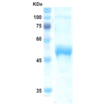 Dengue type 3 NS1 protein (insect cell)